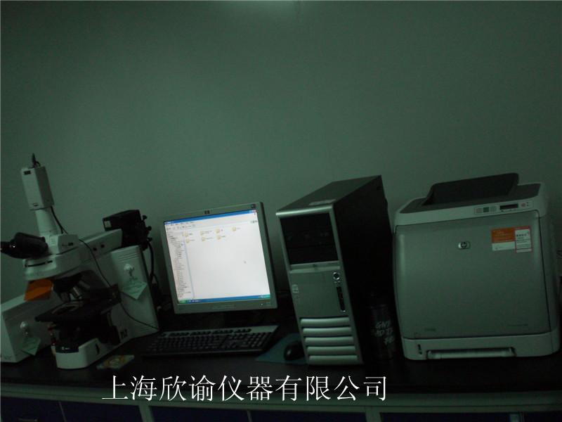 [欄目置頂]染色體分析系統(tǒng)（XY-RS-A2）、高配核型分析系統(tǒng)